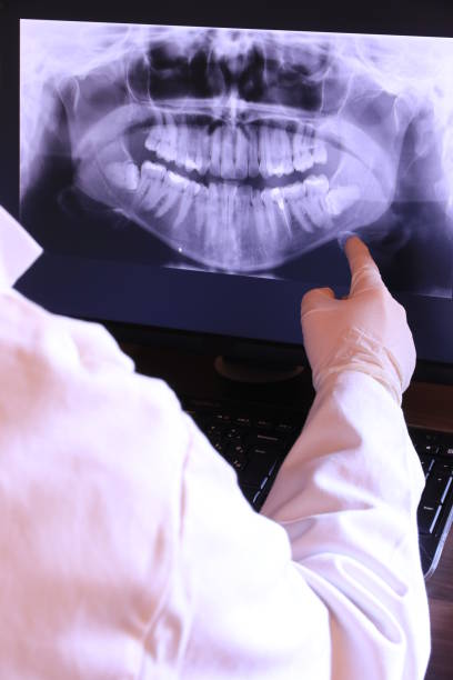 Best Emergency Root Canal Treatment in Memphis, MO